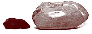 The photo above shows the comparison between a healthy liver and the liver used to make foie gras.