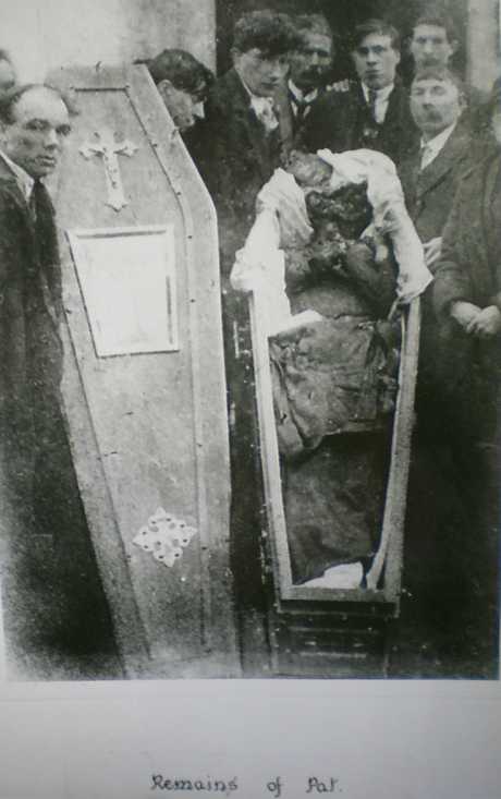 The body of Patrick Loughnane after torture by members of the RIC
